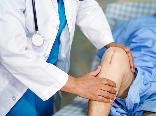 Healthcare provider examining post-surgical knee with visible incision, illustrating orthopedic recovery, wound care, and post-acute rehabilitation support